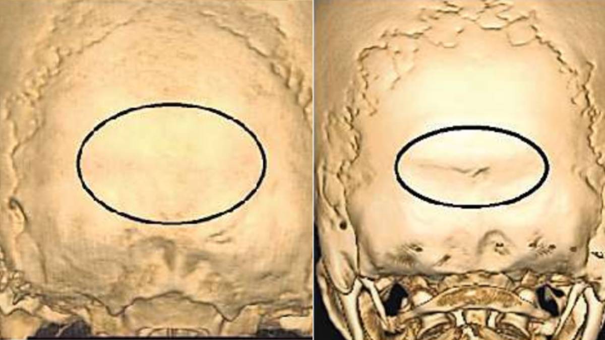 gender identification from skull forensic science breakthrough