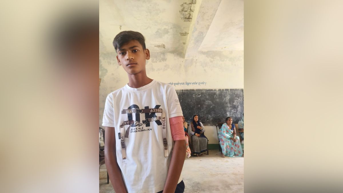 teacher assaults student in palamu hand fractured