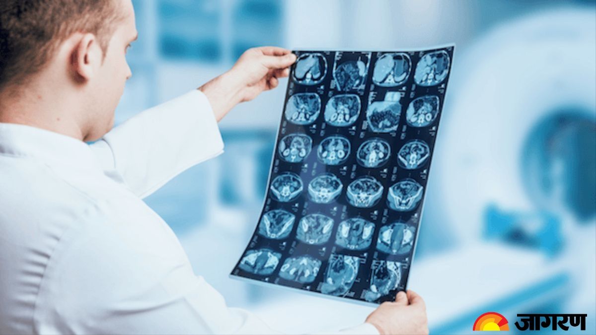 delhi hospitals to get 230 new radiology machines