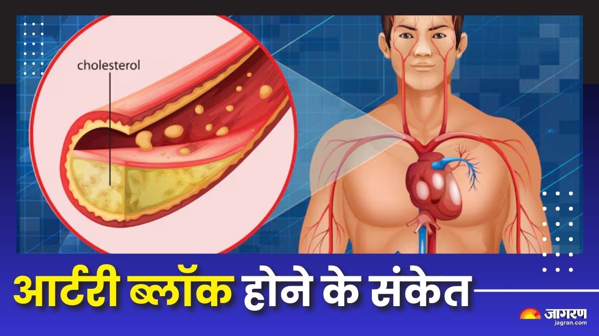 6 silent warning signs of artery blockage check details here