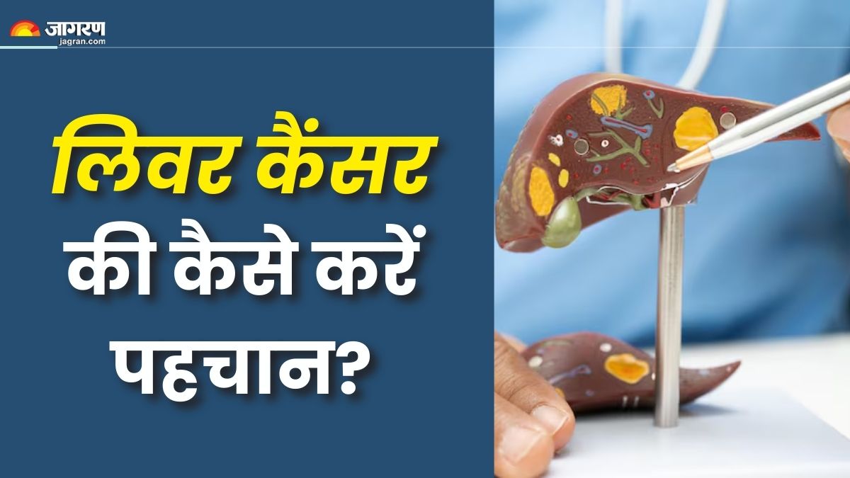 7 signs of liver cancer seen in body check details here