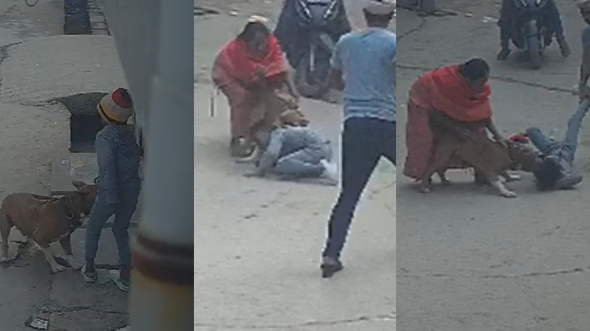 pitbull attack child severely injured in delhi owner arrested