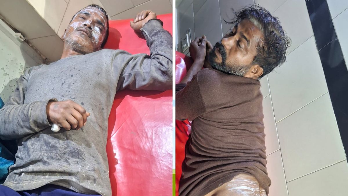 agra industrial area chemical explosion injures three workers