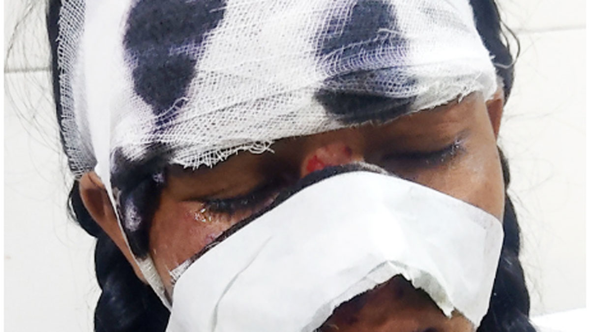 monkeys attack intermediate student on her way to school seriously injured