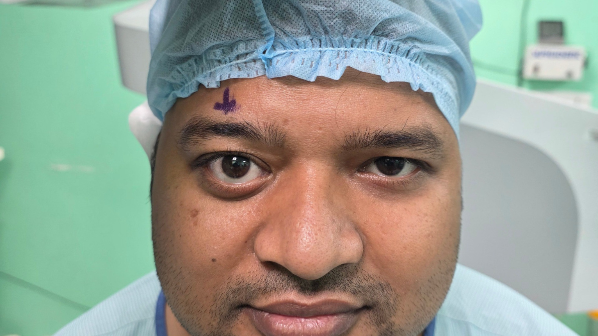 doctors save eyesight by removing grapesized tumor