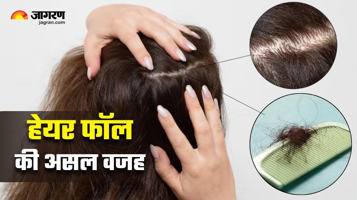 winter hair fall nutritionist reveals 3 causes of seasonal hair shedding and easy fixes
