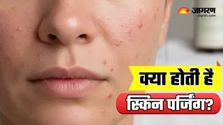 क्यों नई स्किनकेयर शुरू करते ही त्वचा पहले खराब दिखने लगती है? (Image Source: AI-Generated)
