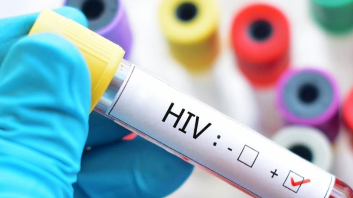 bareillyoldcityhivpositivecasesrisekankartolarabritolascreeningarttreatment