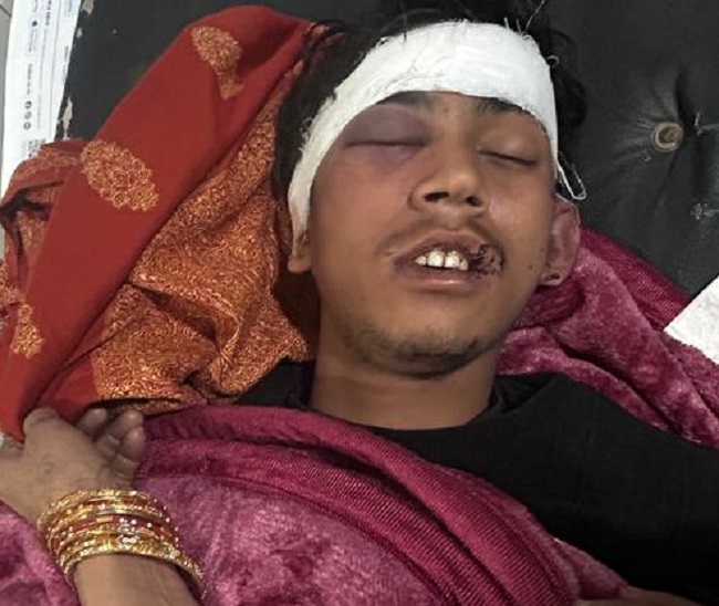 mohali youth found unconscious with injuries after missing overnight