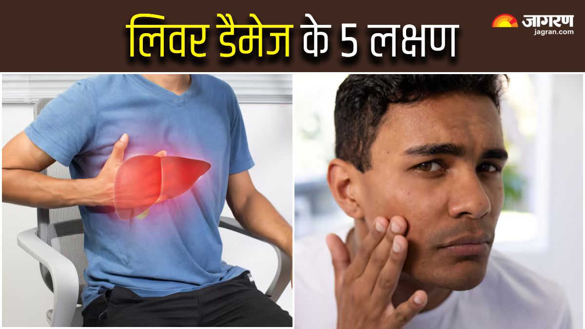 5 skin signs of liver damage you must not ignore