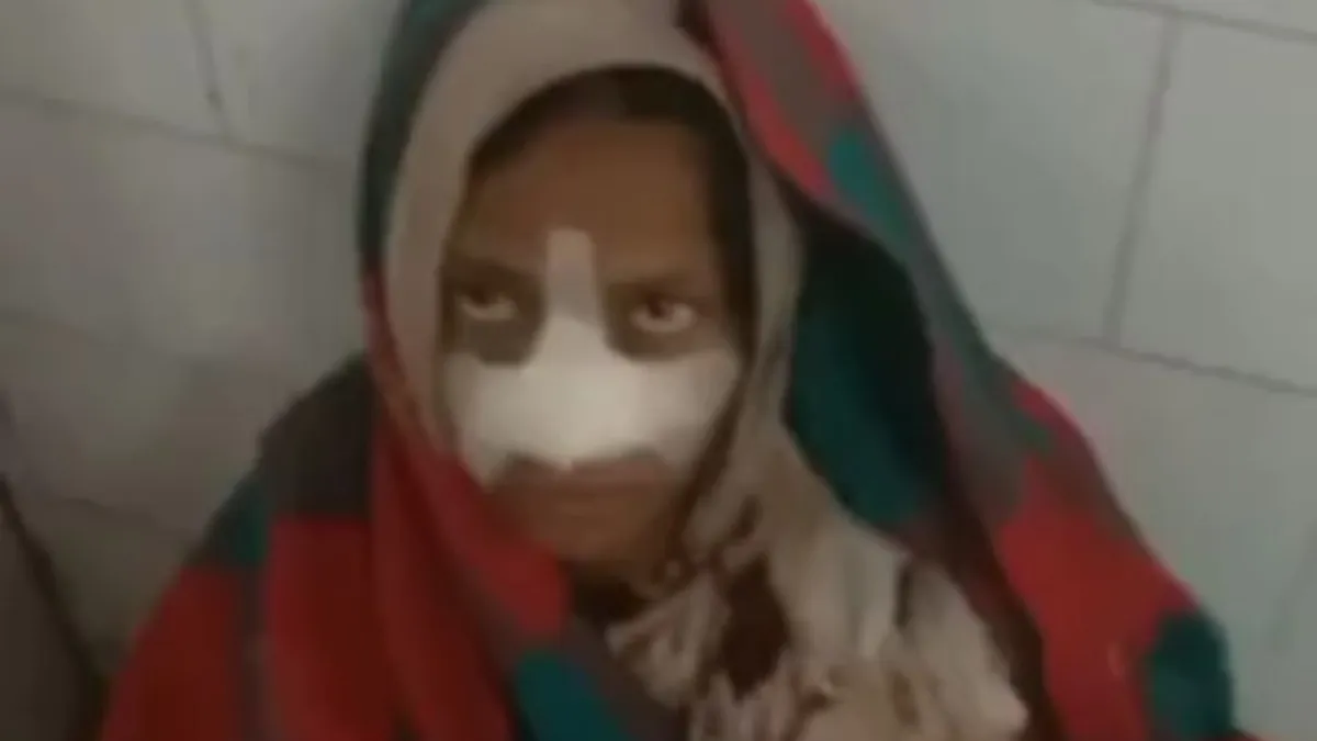 पति से पैसे मांगने पर चिढ़ गई सौतन, काट डाली उसकी नाक