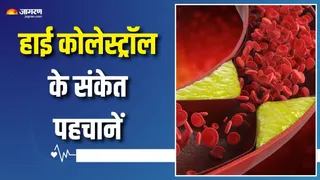 कोलेस्ट्रॉल बढ़ने पर शरीर में कैसे लक्षण नजर आते हैं? (Picture Courtesy: Freepik)