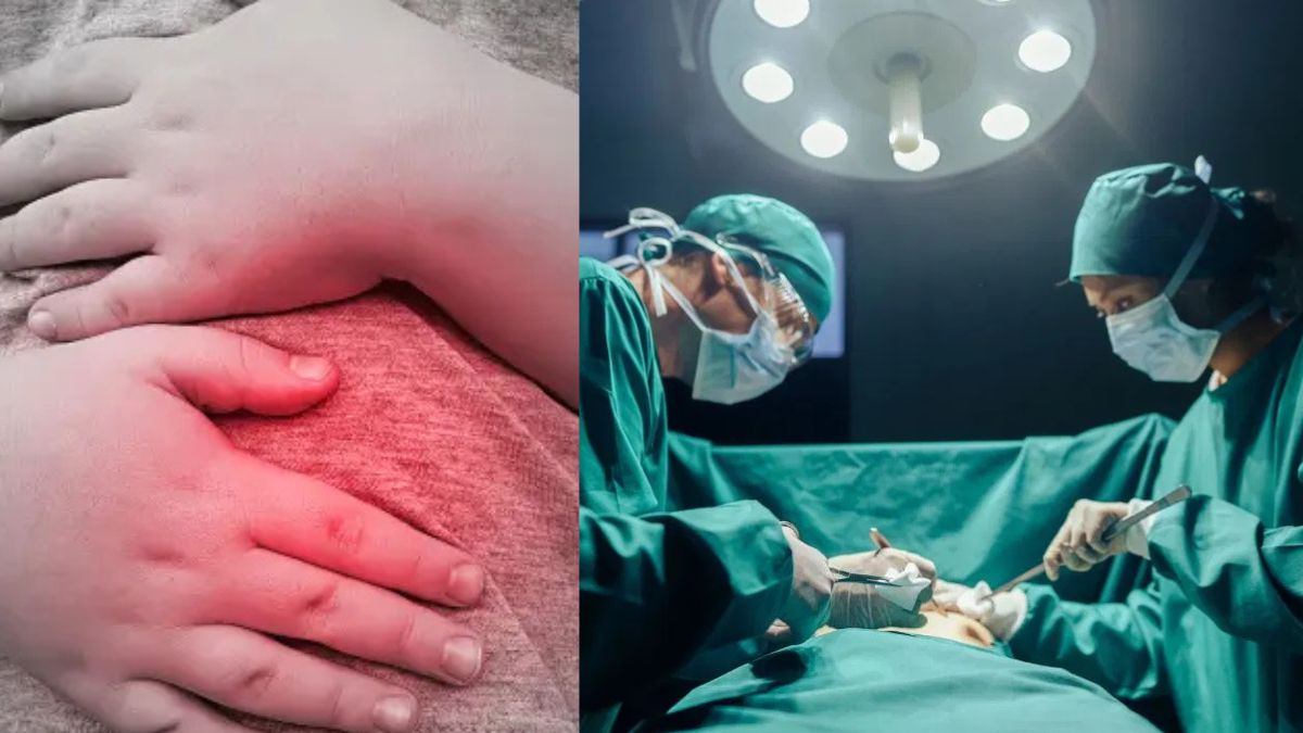 girls stomach pain leads to shocking discovery during surgery