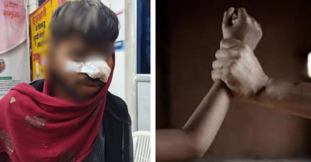 kanpur crime brother in law molested bhabhi cuts husband nose when he intervenes
