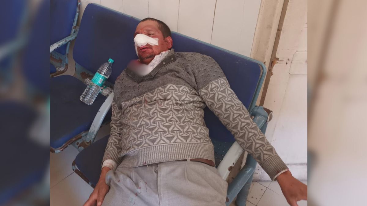 two boatmen clash one breaking other nose at tallital boat stand