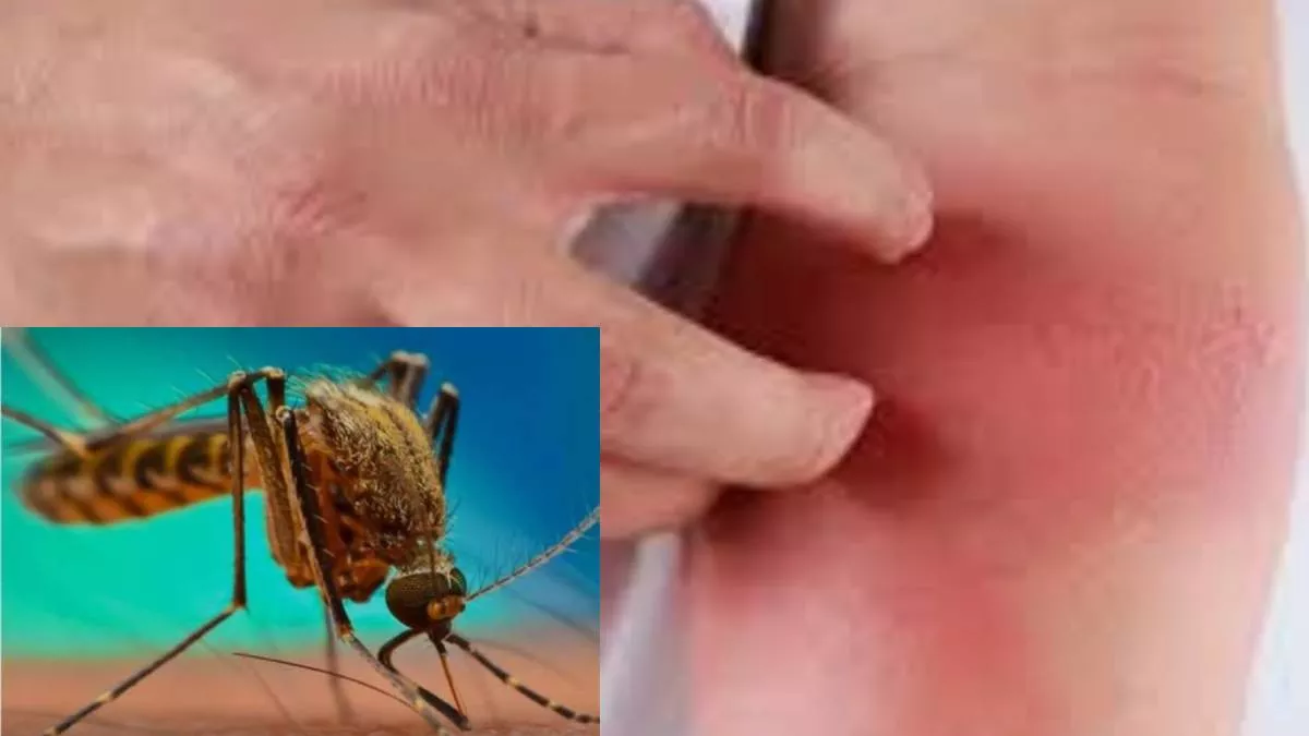 in up q filariasis antigen test will make it easier to identify filariasis patients