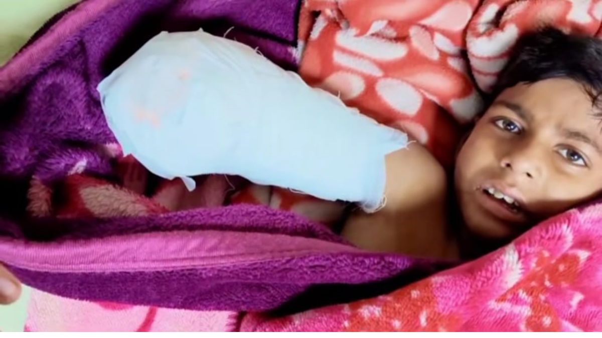 boys arm amputated after botched treatment