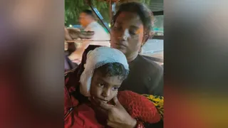 दरवाजे पर खेल रहे बच्चे पर कुत्तों ने किया हमला।