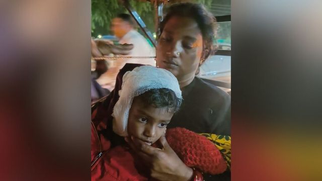 दरवाजे पर खेल रहे बच्चे पर कुत्तों ने किया हमला, सिर पर काटकर किया लहूलुहान
