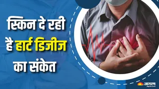 क्या आपकी त्वचा भी दे रही है दिल की बीमारी के ये इशारे? (Picture Courtesy: Freepik)