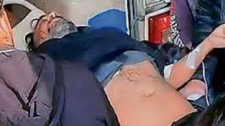 उपचार को ले जाने के दौरान हिस्ट्रीशीटर विनय त्यागी