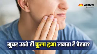 चेहरे पर बार-बार आ रही है सूजन? (Image Source: Freepik)