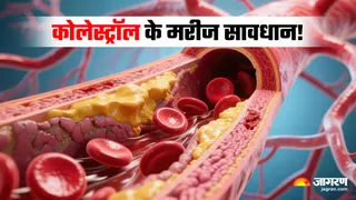 अगर बढ़ा हुआ है कोलेस्ट्रॉल, तो भूलकर भी न खाएं ये 3 चीजें (Image Source: Freepik)