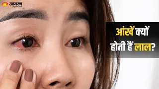 लाल आंखों से हैं परेशान? अपनाएं ये टिप्स (Picture Credit - Canva)