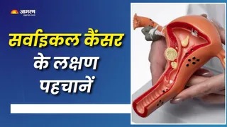 क्यों आसानी से नहीं चलता सर्वाइकल कैंसर का पता? (Picture Courtesy: Freepik)
