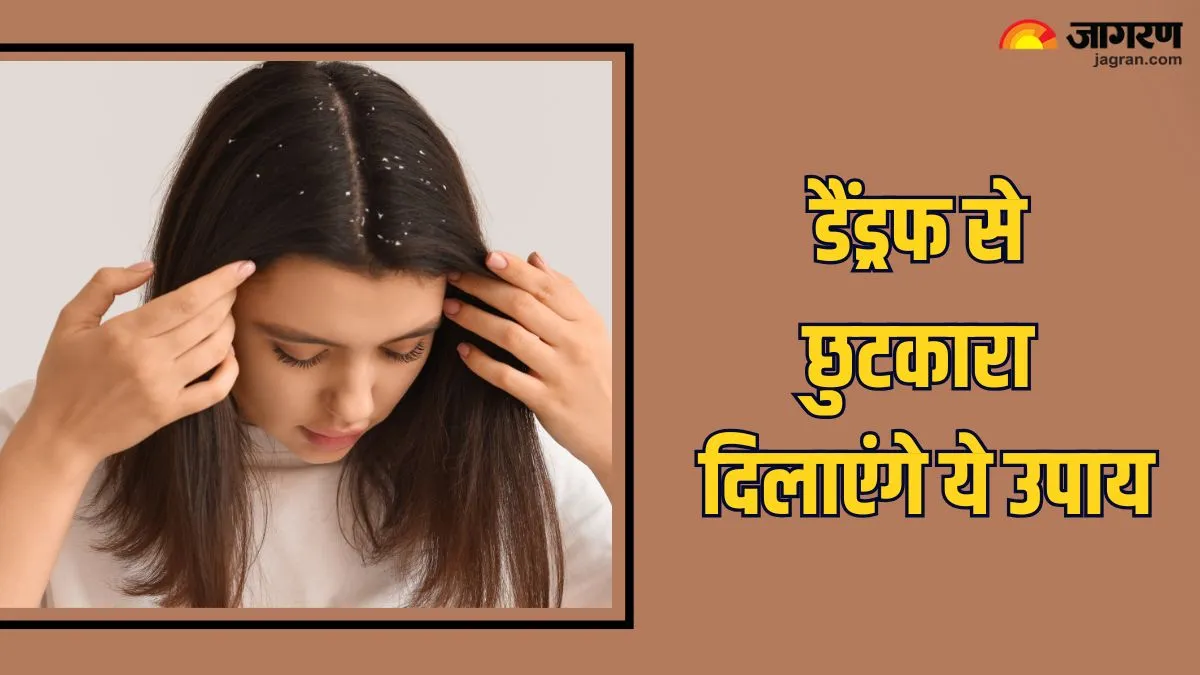 शर्मिंदगी का कारण बन रहा है कंधों पर गिरता डैंड्रफ? तो जड़ से सफाया करेंगे ये 6 घरेलू नुस्खे