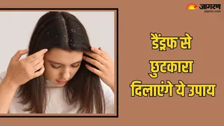 सर्दियों में डैंड्रफ से छुटकारा पाने के लिए नेचुरल नुस्खे (Picture Credit - Canva)