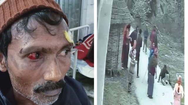मुजफ्फरपुर में क्रूरता: काम से इनकार करने पर मजदूर को पीटा, भीम आर्मी ने किया प्रदर्शन 
