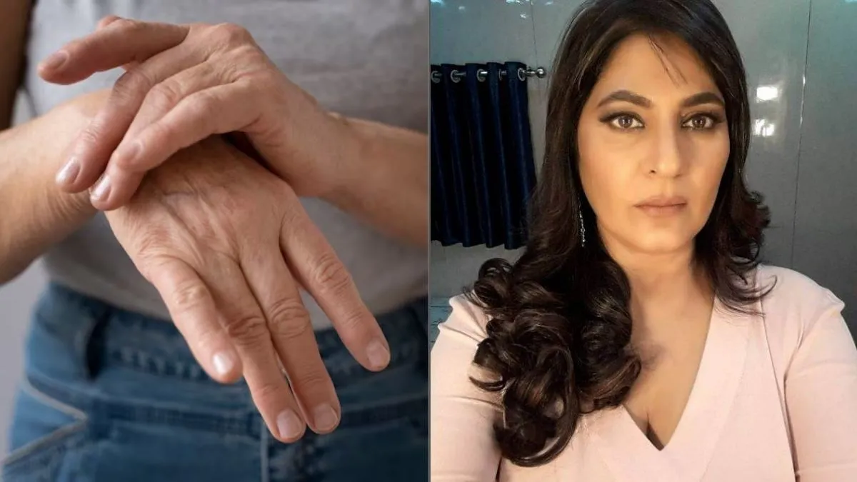 क्या चोट ठीक होने के बाद भी नहीं जा रहा दर्द? हो सकता है CRPS, जिसका शिकार हुईं अर्चना पूरन सिंह