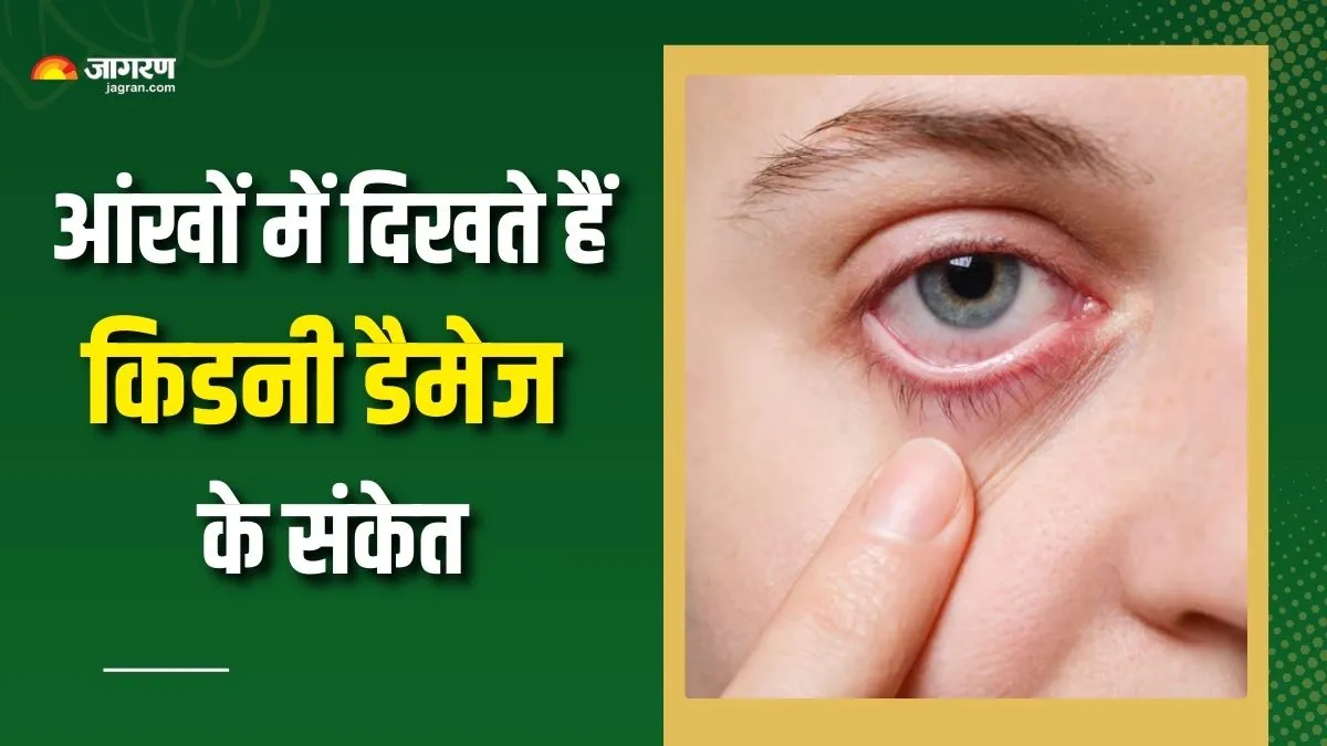 किडनी खराब होने से पहले आंखें देती हैं 6 संकेत, सुबह उठते ही जरूर करें चेक