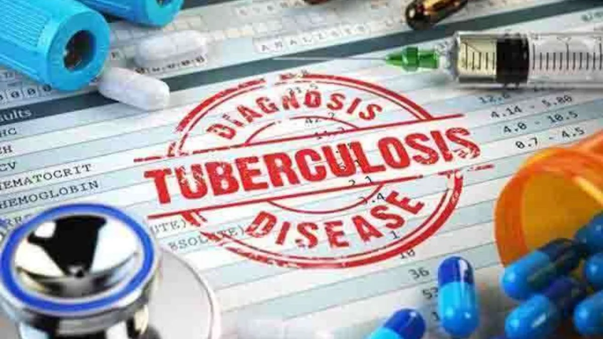 यूपी में होटल-रेस्टोरेंटकर्मियों की टीबी जांच अनिवार्य, संक्रमण रोकने को योगी सरकार का बड़ा फैसला