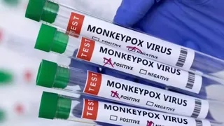 Mpox का शिकार हुए 10 में से 9 लोगों ने की थी विदेश यात्रा, नए वेरिएंट पर स्टडी में बड़ा खुलासा