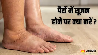 पैरों की सूजन से जल्द राहत पाने के आसान तरीके (Image Credit - Canva)