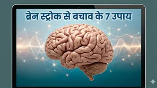 ब्रेन स्ट्रोक से बचाव: इन 7 जोखिम कारकों को समझें और नियंत्रित करें (Picture Credit- AI Generated)