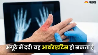 अंगूठे के दर्द से परेशान थम्ब आर्थराइटिस के लक्षण और उपचार (Picture Credit- AI Generated)
