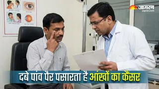 World Cancer Day 2026: आंखों के कैंसर के वो संकेत जो हर किसी को होने चाहिए पता (Image Source: AI-Generated)