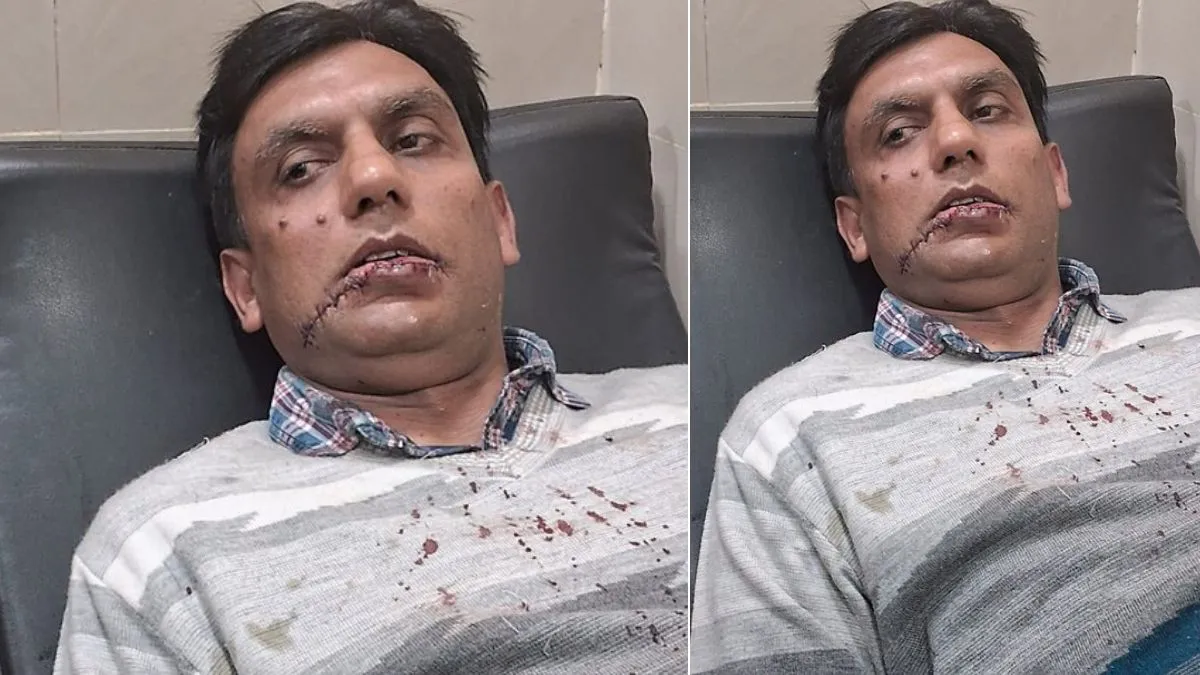 प्रतिबंध का असर नहीं, चाइनीज मांझे से लखनऊ में रिटायर्ड फौजी गंभीर रूप से  चोटिल - banned chinese manjha retired army man injured due to chinese manjha