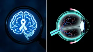 एक आई टेस्ट से मुमकिन होगी अल्जाइमर की शुरुआती पहचान (Image Source: Freepik)