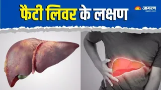 फैटी लिवर की समय पर पहचान जरूरी। सांकेतिक तस्वीर