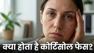 क्या स्ट्रेस के कारण चेहरे की रौनक कम हो सकती है? (AI Generated Image)
