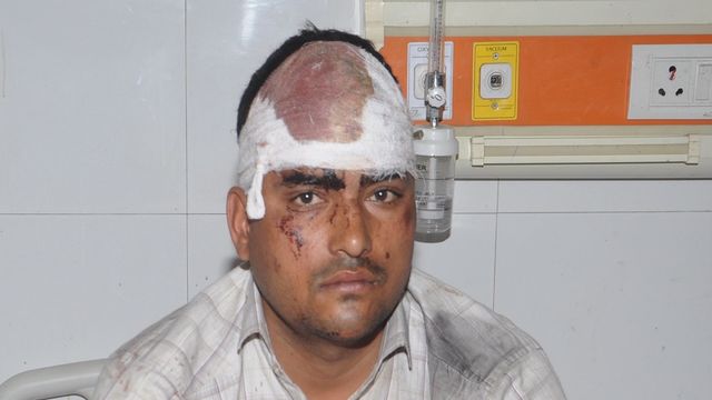 होटल पर इतनी सी बात पर संचालक ने लोहे की रॉड से सिपाही पर किया जानलेवा हमला