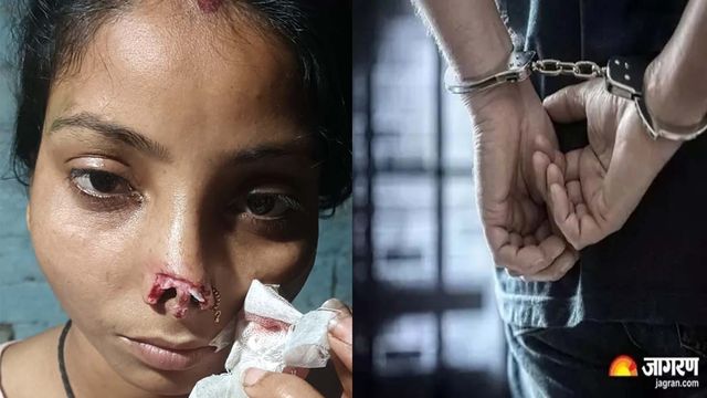 कटिहार में ससुराल आए पति ने पत्नी की काट दी नाक, मोबाइल में दूसरी महिला के साथ वीडियो से खुला राज

