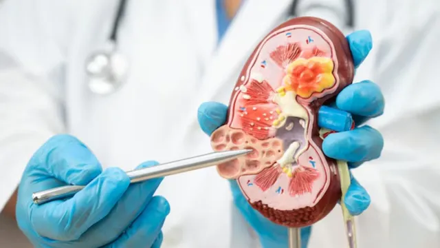 किडनी डिजीज को साइलेंट किलर क्यों कहा जाता है? डॉक्टर ने बताए किन लक्षणों से रहना चाहिए सावधान