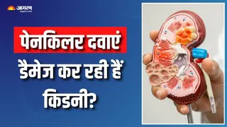 क्या आप भी डॉक्टर से पूछे बिना लेते हैं पेनकिलर दवाएं? (Picture Courtesy: Freepik)