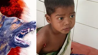 कुत्तों के हमले से घायल बच्ची।