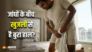 पसीने से होने वाले फंगल इन्फेक्शन को न करें नजरअंदाज (Image Source: AI-Generated)